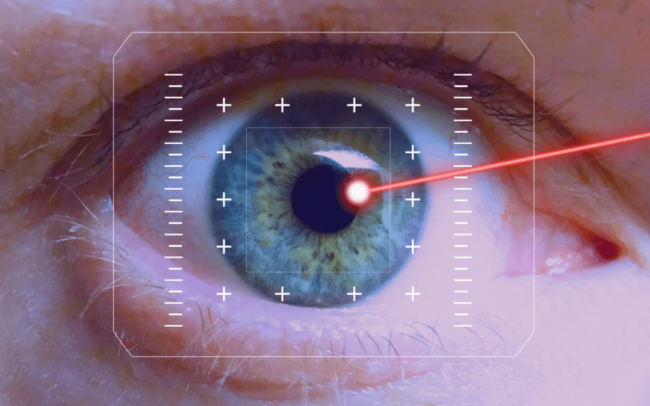 Lasik Eye Surgery In Chicago South Loop